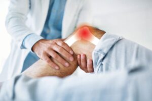 1018 Arthritis in Knee 1024x683 1