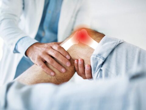 1018 Arthritis in Knee 1024x683 1
