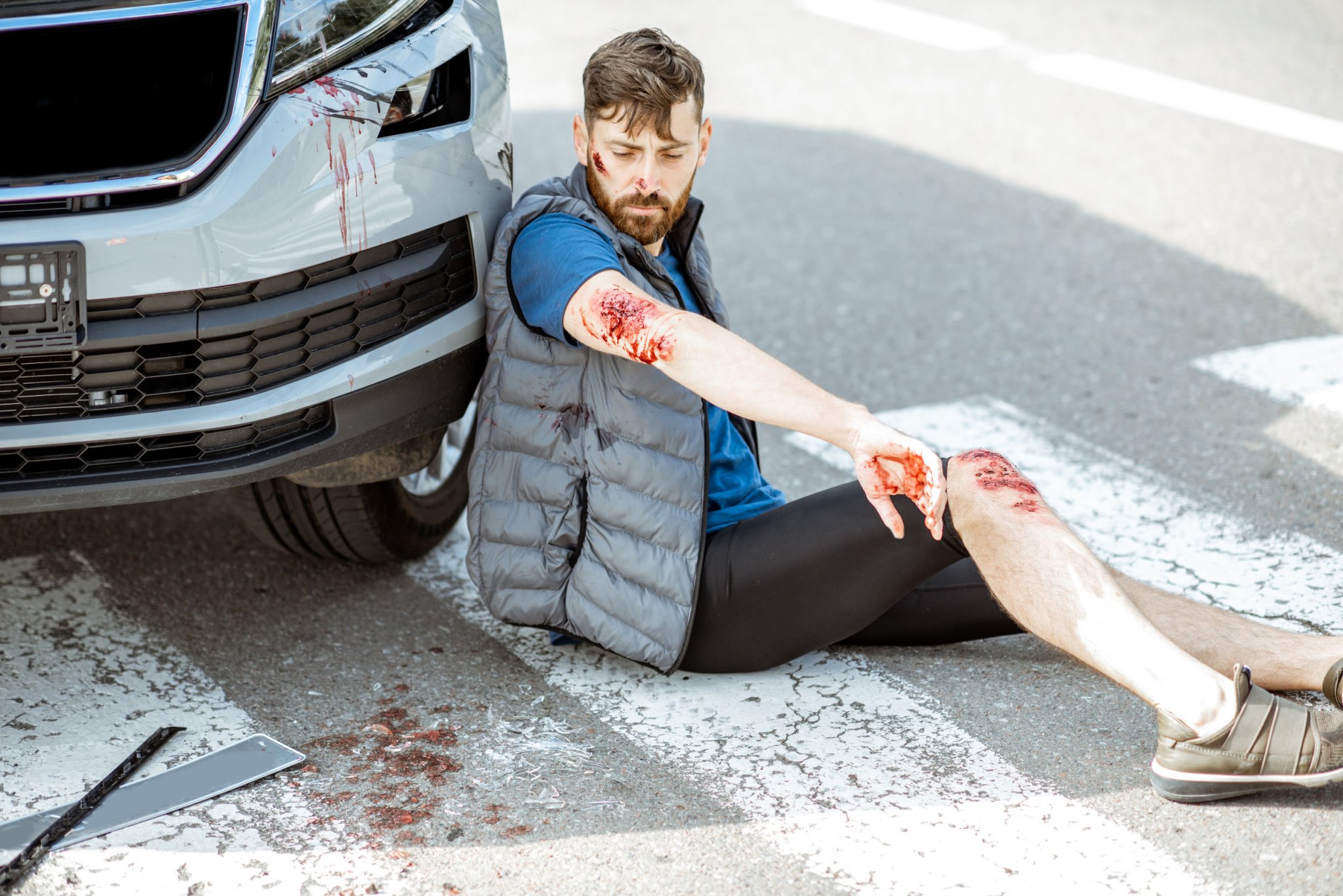 Car Accident Pedestrian 2048x1367 1